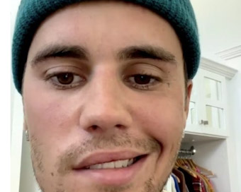 Justin Bieber says a virus has temporarily paralyzed half of his face in a video showing his symptoms