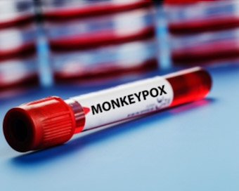 Monkeypox in Delhi: Nigerian man tests positive for monkeypox, 2nd case in city