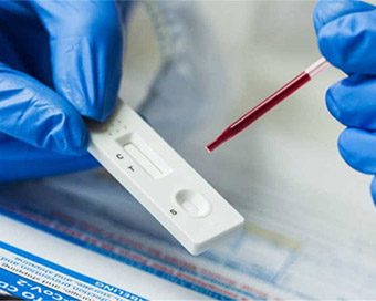 NRI scientist develops test that visually detects coronavirus in 10 mins