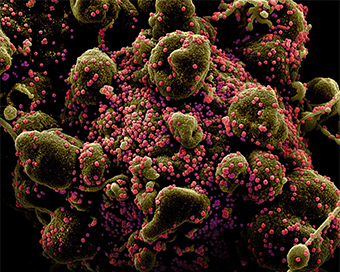 Coronavirus cases top 7.5 million worldwide: JHU