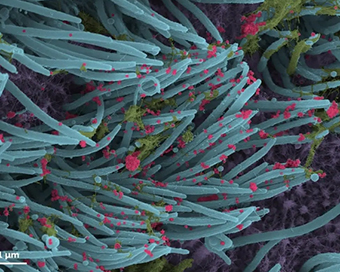 New image of coronavirus released as seen up close inside human lungs