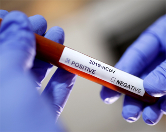 ICMR: 1.79L tested for coronavirus; 7,703 positive