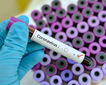 Covid cases in Telangana cross 47,000 mark