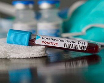 Coronavirus: Karnataka records 6th death, total cases 191 