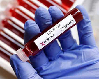 31,083 tests for coronavirus on Friday, 1,443 found positive: ICMR