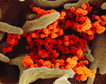 Coronavirus could result in more HIV cases, AIDS-related deaths: UN