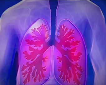 New research explains severe virus attacks on lungs